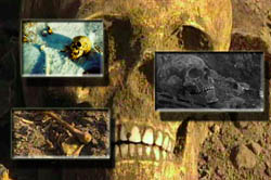 bones